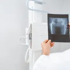 Lekarz analizuje RTG miednicy z endoprotezą stawu biodrowego. Czy USG czy RTG lepsze? RTG pokazuje kości i implant.