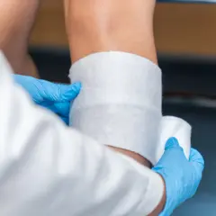 Opatrunek na ranie. Pielęgniarka w niebieskich rękawiczkach zakłada biały opatrunek. Czas wycieku płynu surowiczego z rany jest różny.