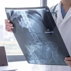 Lekarz analizuje RTG jamy brzusznej, co wykrywa zmiany w kręgosłupie i miednicy.