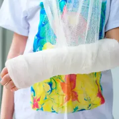Dziecko z ręką w gipsie i temblaku. Czy przy złamaniu zawsze jest opuchlizna?