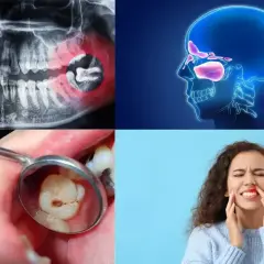 RTG szczęki, anatomia zatok, zepsuty ząb i kobieta z bólem twarzy – wszystko to może wskazywać na ból ucha od zęba.