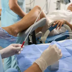 Personel medyczny przygotowuje cewnik. Objawy zapchanego cewnika mogą być niepokojące, ale procedura jest rutynowa.