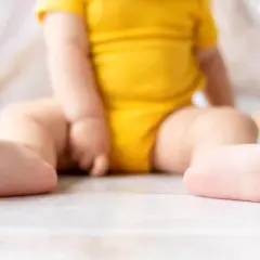 Dziecko w żółtym body siedzi na podłodze. Widoczne są jego stópki, które mogą sugerować płaskostopie u dzieci.