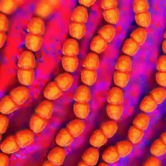Złociste, ziarniste skupiska bakterii, przypominające paciorki, to Enterococcus faecalis. Tworzą one łańcuszki, unosząc się w fioletowo-czerwonym środowisku.