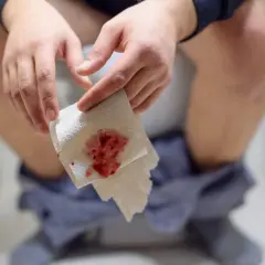 Dłoń trzymająca papier toaletowy z krwią, sugerujący problemy z hemoroidami, nawet u dzieci.