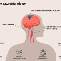 Gdy kręci się w głowie, przyczyną może być blokada tętnicy szyjnej, problemy z krążeniem mózgu, choroby ucha, mózgu, metaboliczne, sercowo-naczyniowe lub leki.