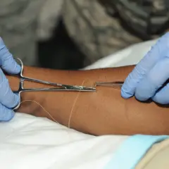 Ręce w niebieskich rękawiczkach używają narzędzi do szycia, tworząc wystający szew wewnętrzny na skórze.