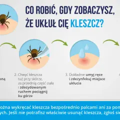 Instrukcja usuwania kleszcza: przygotuj pęsetę i alkohol, chwyć kleszcza blisko skóry i pociągnij. Umyj ręce i obserwuj miejsce po ukłuciu.