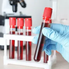 Lekarz lub diagnosta laboratoryjny może wystawić skierowanie na markery nowotworowe. W tle mikroskop i probówki z krwią.