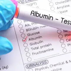 Rękawiczka medyczna trzyma probówkę z napisem "Albumin - Test". Na formularzu zaznaczono "Albumin", co sugeruje badanie poziomu albuminy.