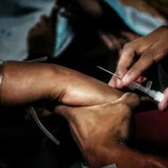 Zbliżenie na rękę, gdzie pielęgniarka wkłada igłę do żyły do pobierania krwi.