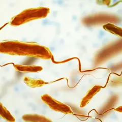 Bakterie Vibrio cholerae, przyczyna cholery. Objawy mogą być groźne.
