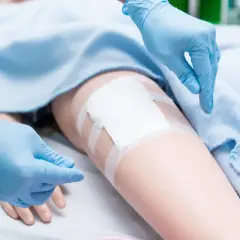 Ręce w niebieskich rękawiczkach zmieniają opatrunek na nodze, pokazując prawidłową pielęgnację rany pooperacyjnej w domu.