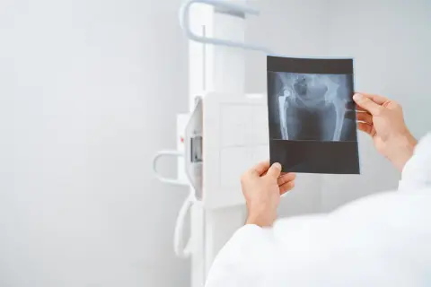 Lekarz analizuje RTG miednicy z endoprotezą stawu biodrowego. Czy USG czy RTG lepsze? RTG pokazuje kości i implant.