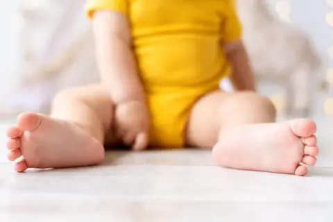 Dziecko w żółtym body siedzi na podłodze. Widoczne są jego stópki, które mogą sugerować płaskostopie u dzieci.