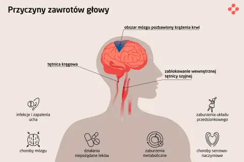 Gdy kręci się w głowie, przyczyną może być blokada tętnicy szyjnej, problemy z krążeniem mózgu, choroby ucha, mózgu, metaboliczne, sercowo-naczyniowe lub leki.