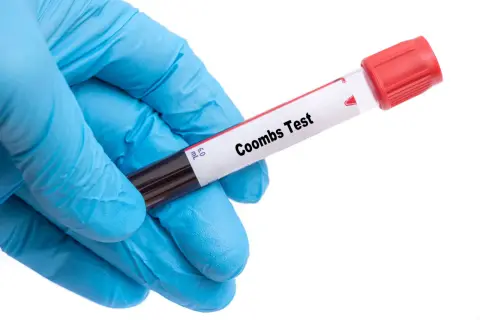 Rękawiczka w kolorze niebieskim trzyma probówkę z krwią do badania. Na etykiecie widnieje napis "Coombs Test", wskazujący na wykonanie odczynu Coombsa.