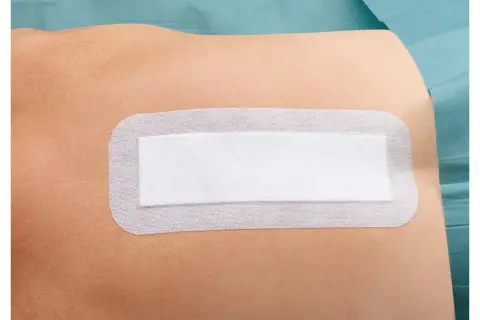 Biały, sterylny plaster na skórze, chroniący ranę po operacji. Zapewnia komfort i bezpieczeństwo podczas rekonwalescencji.