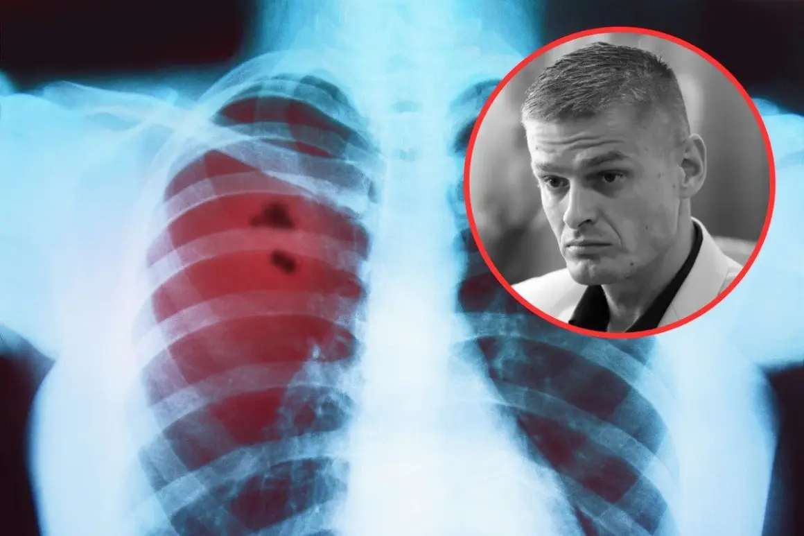 RTG płuc z zaczerwienionymi zmianami, sugerującymi raka płuc objawy. Obok twarz mężczyzny w okręgu.