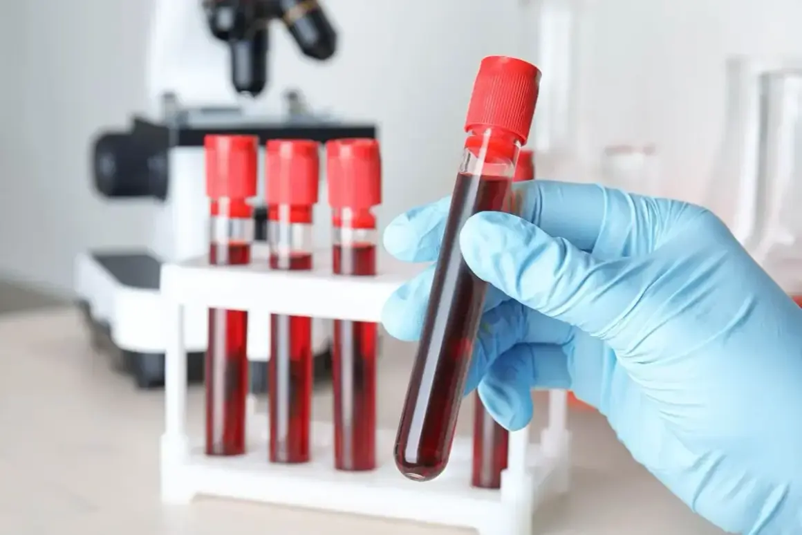 Lekarz lub diagnosta laboratoryjny może wystawić skierowanie na markery nowotworowe. W tle mikroskop i probówki z krwią.
