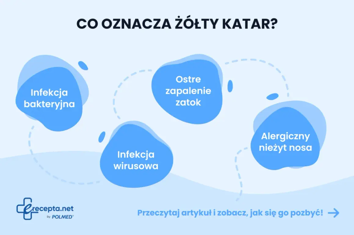 Żółty katar może oznaczać infekcję bakteryjną, wirusową, ostre zapalenie zatok lub alergiczny nieżyt nosa. Dowiedz się więcej.