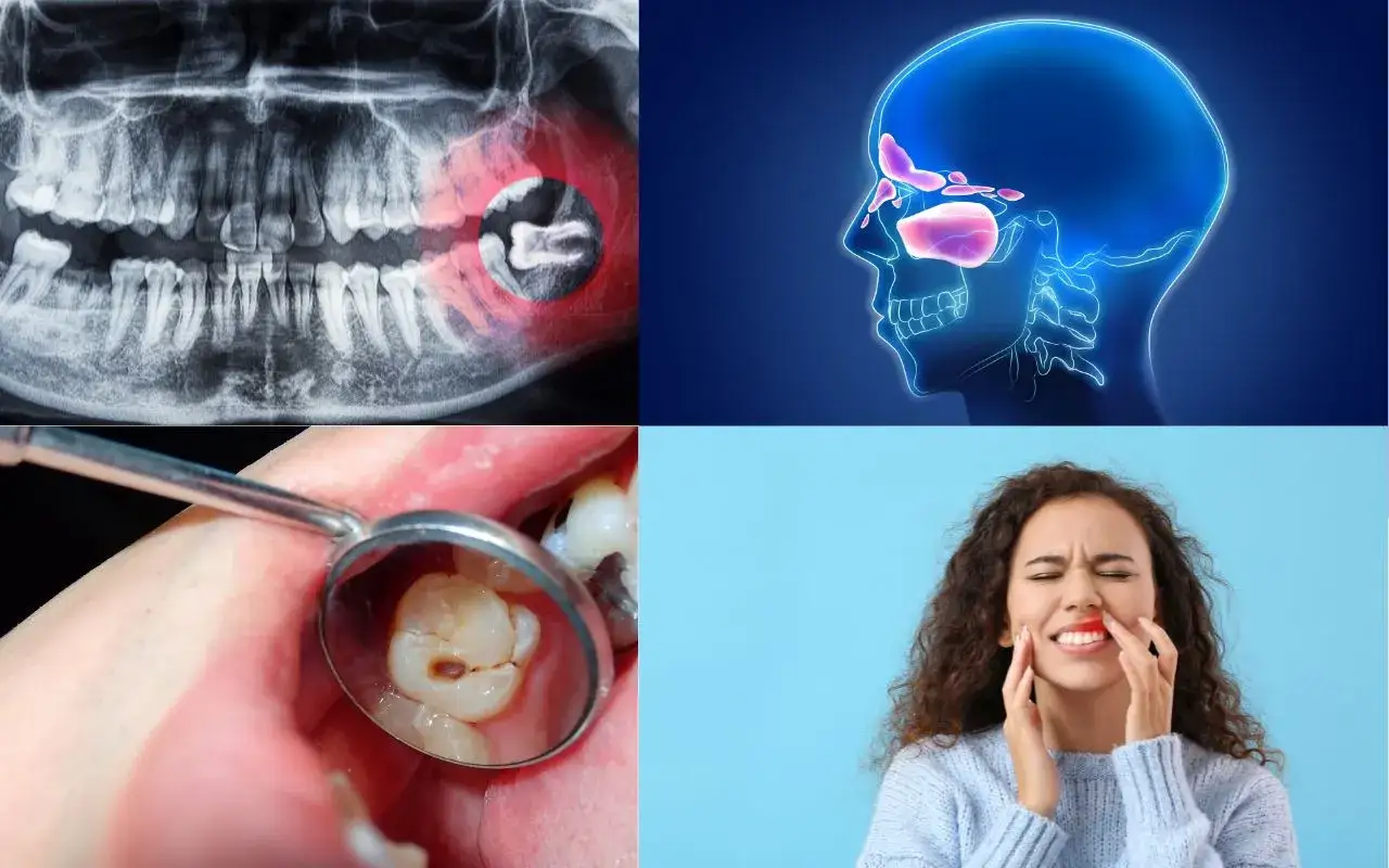 Rentgen szczęki, schemat zatok, ząb w lustrze dentystycznym i kobieta z bólem twarzy. Ból ucha od zęba może być uciążliwy.
